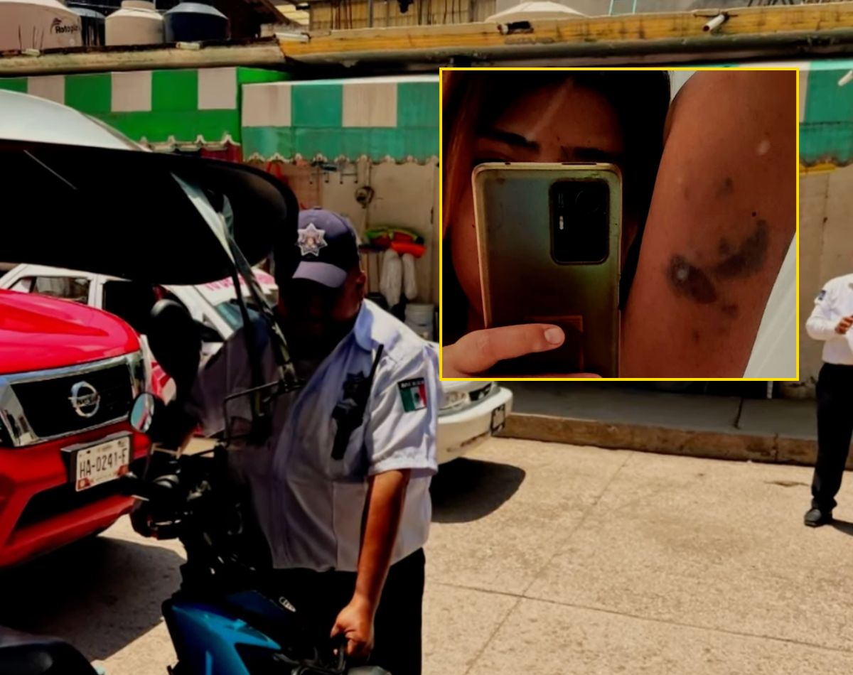 agresion policial