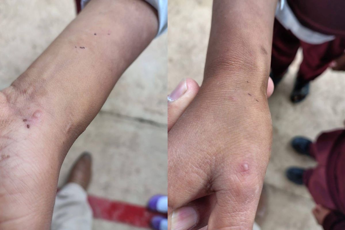 Foto: Hechos Montaña Digital