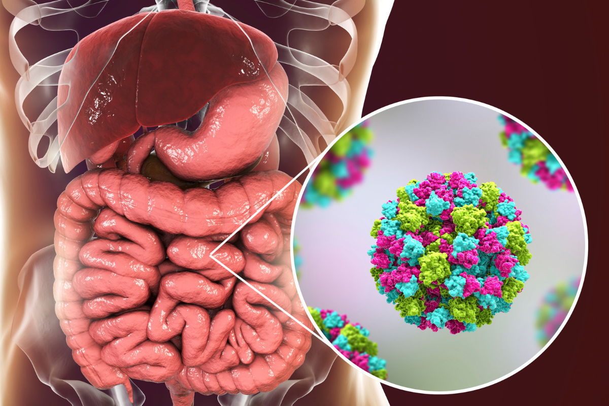 norovirus 5