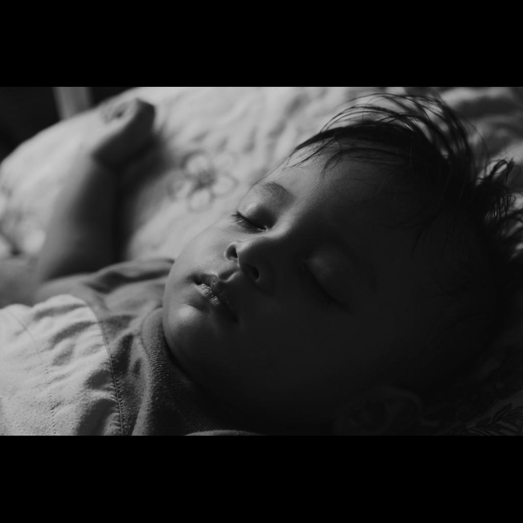 Sarampión-en-Guerrero